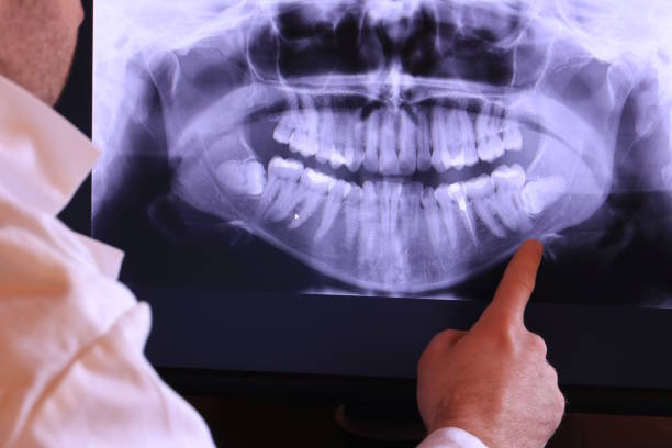 Best Emergency Treatment for Dental Infections or Abscesses in Mount Jackson, VA