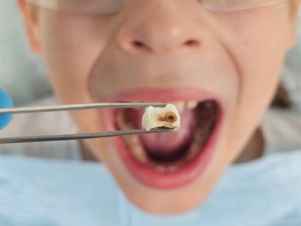 Best Pediatric Emergency Dentist in Mount Jackson, VA